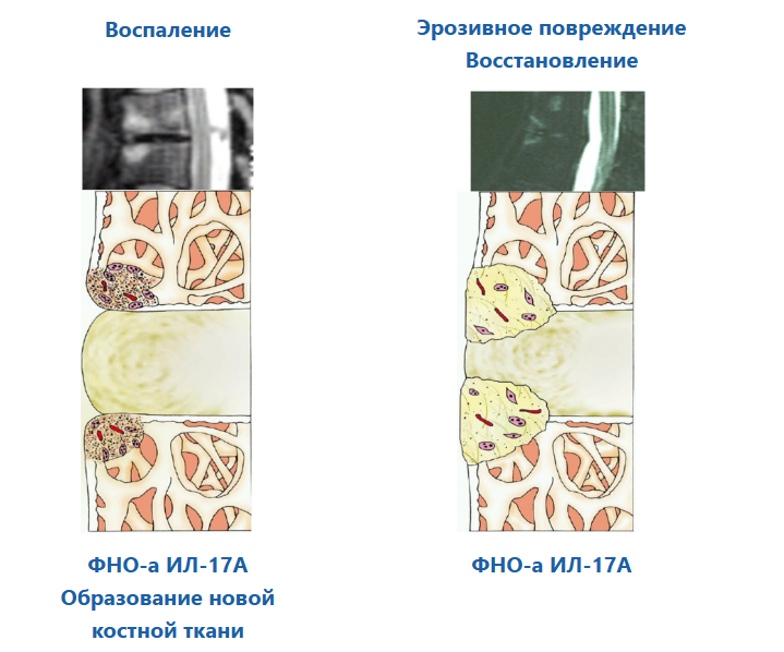 Эрозивное повреждение Восстановление