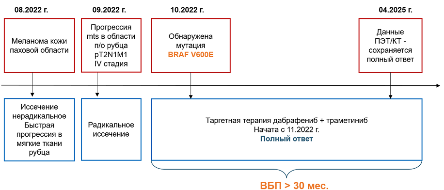 Резюме