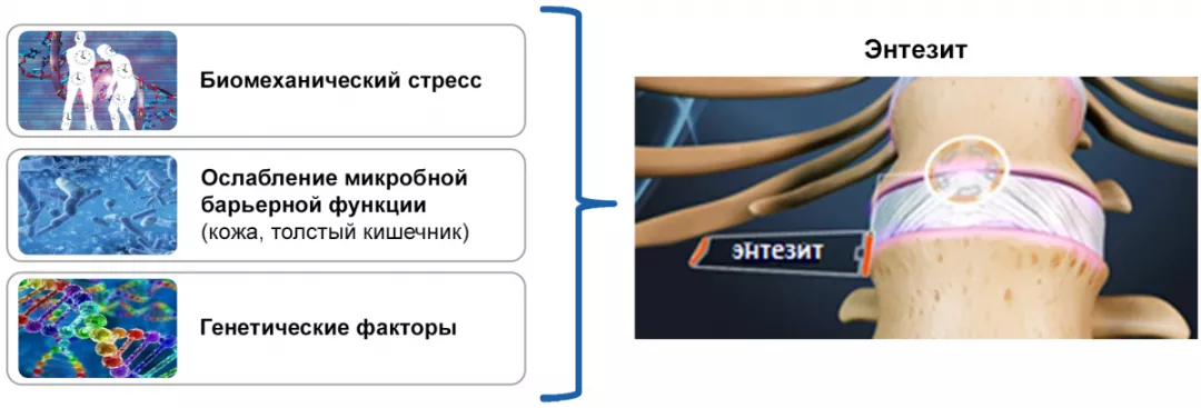 Комбинация механического и микробного факторов синергично активируют острый воспалительный ответ в энтезисах