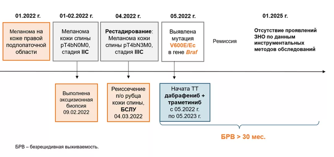 Резюме