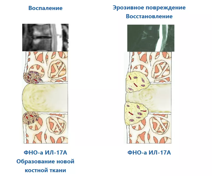 Эрозивное повреждение Восстановление