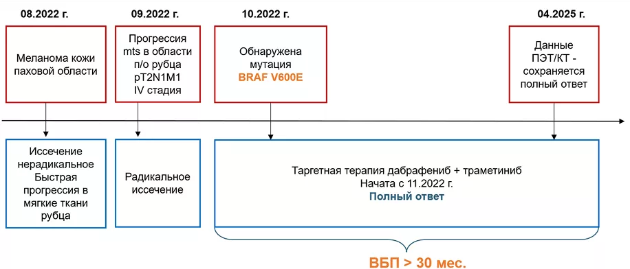 Резюме