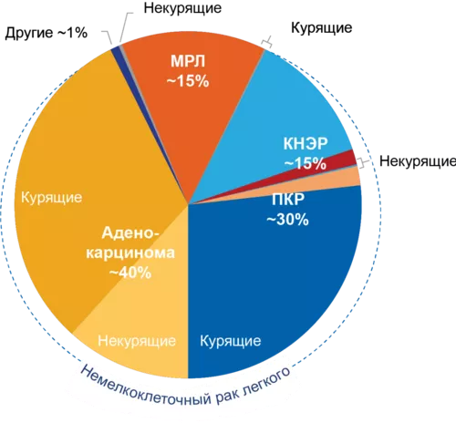 Гистологические варианты рака легкого