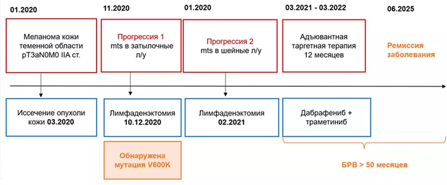 Резюме