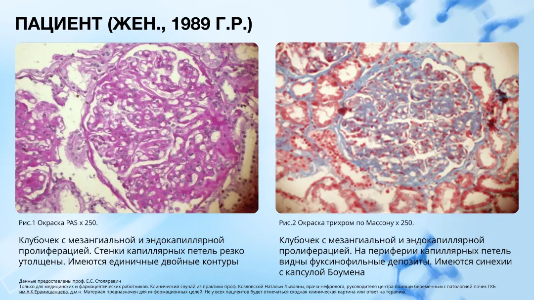 Клинический случай 2